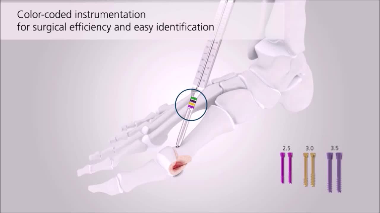 CCHS FnA Overview Animation