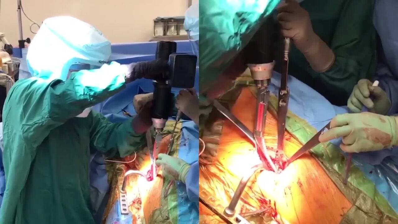 Dr Joel Matta Hip Procedure Video