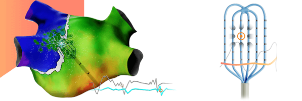 Left atrial map with complex signals tagged automatically with the OPTRELL™ Catheter and OPTRELL™ Catheter