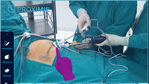 Image 2: A remote instructor uses an AR overlay to more precisely guide the operating surgeons (external camera view)
