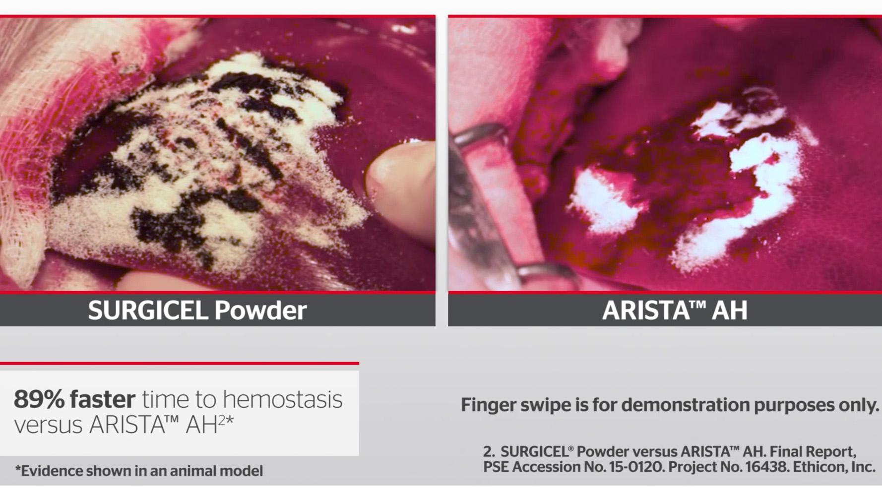  SURGICEL® Powder Competitive Overview
