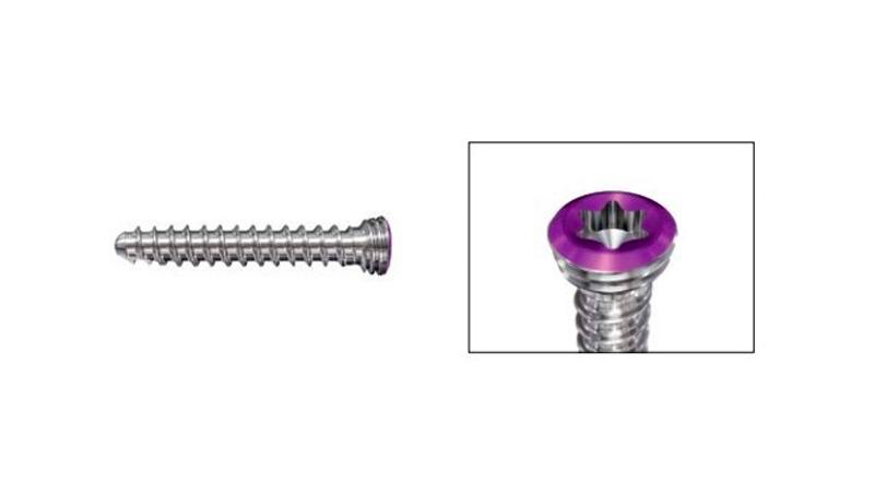 Variable Angle Locking Hand System Locking Screws Chart