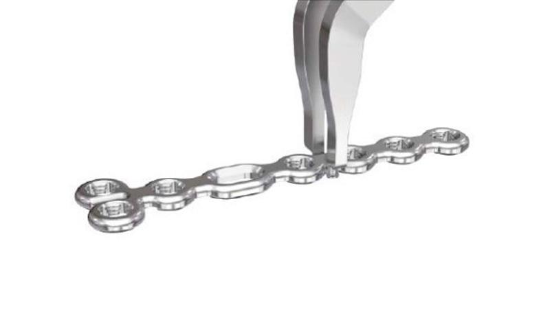 Variable Angle Locking Hand System plate holder placed on outside edges of plate