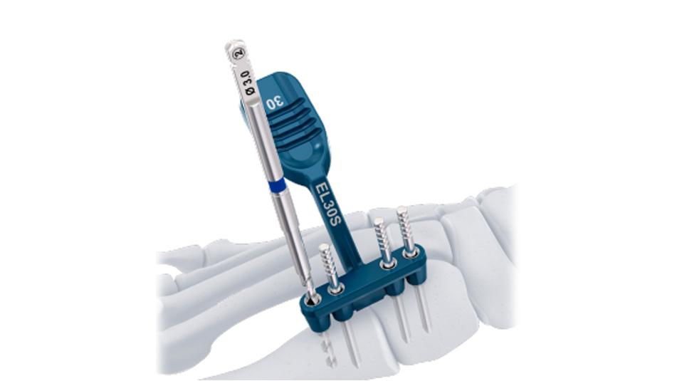 BME ELITE Drill Guide kit used to insert pull pins for hallux valgus deformity correction