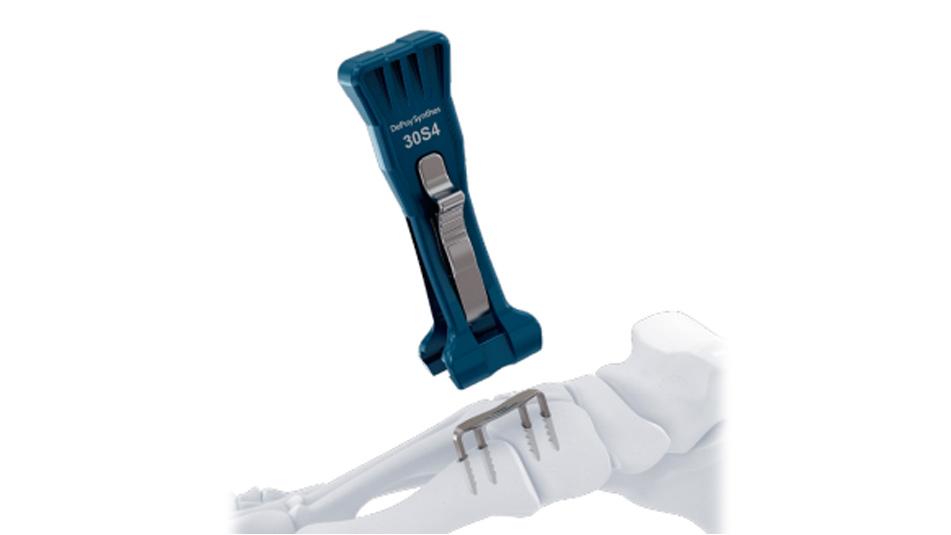 BME ELITE Implant inserted into drill holes using insertion tool for hallux valgus deformity correction.