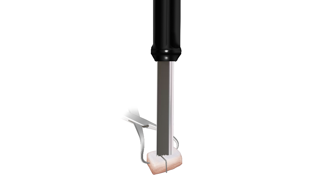 Distal Tibial Allograft (DTA) Preparation 1