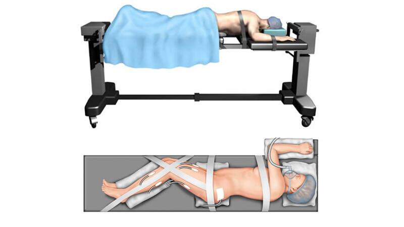 example of patient positioned in prone or lateral decubitus position for percutaneous pedicle screw placement