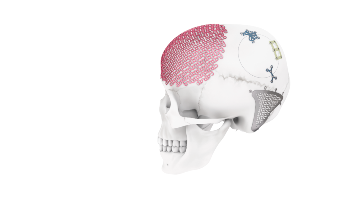 MatrixNEURO shown on a skull