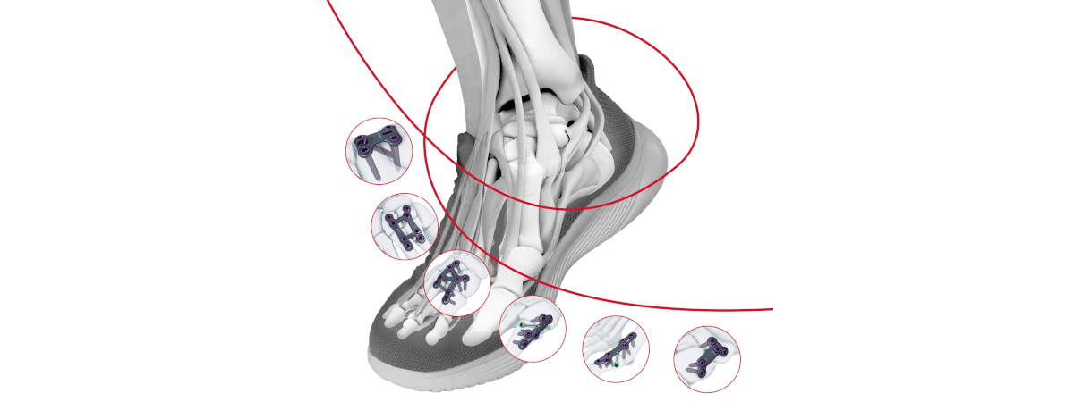 Illustrated skeletal foot wearing a shoe that is surrounded by various sketches of TriLEAP™ plates.