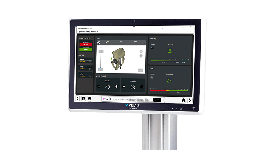 CUPTIMIZE™ Hip-Spine Analysis