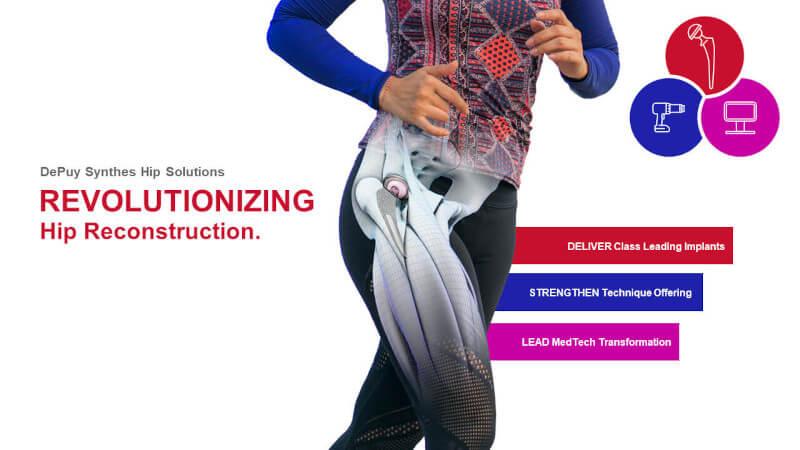 Revolutionizing Hip Reconstruction